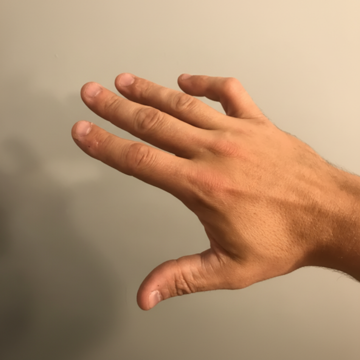 Fabrication d’orthèse sur mesure Laval